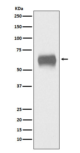 Western blot analysis of CD5 expression in human plasma lysate.