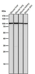 All lanes use the Antibody at 1:2K dilution for 1 hour at room temperature.