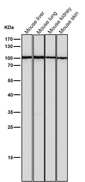 All lanes use the Antibody at 1:2K dilution for 1 hour at room temperature.