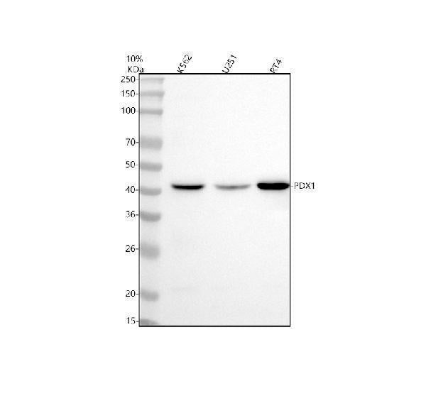 Anti-PDX1/Ipf1 Rabbit Monoclonal Antibody