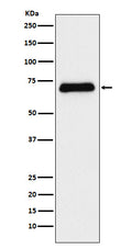 Western blot analysis of Serotonin transporter expression in Human fetal liver lysate.