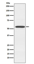 Western blot analysis of Cytochrome P450 2D6 expression in K562 cell lysate.