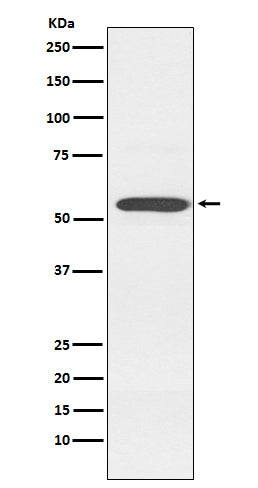 Western blot analysis of Cytochrome P450 2D6 expression in K562 cell lysate.