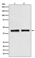 Western blot analysis of SNF5 in (1) HeLa cell lysate; (2) K562 cell lysate.