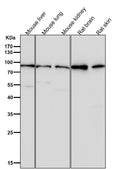 All lanes use the Antibody at 1:3W dilution for 1 hour at room temperature.