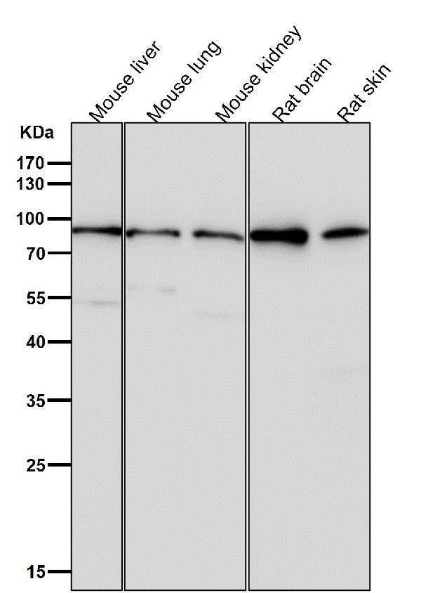 All lanes use the Antibody at 1:3W dilution for 1 hour at room temperature.