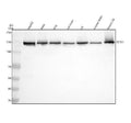 Anti-SF3B1 Rabbit Monoclonal Antibody