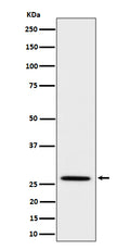 Western blot analysis of Adiponectin expression in mouse kidney cell lysate.