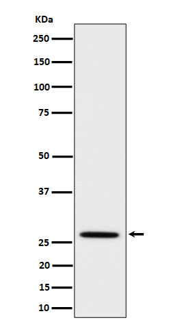 Western blot analysis of Adiponectin expression in mouse kidney cell lysate.
