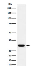 Western blot analysis of Adiponectin expression in human plasma lysate.