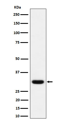 Western blot analysis of Adiponectin expression in human plasma lysate.