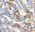 Anti-CYP1B1 Rabbit Monoclonal Antibody