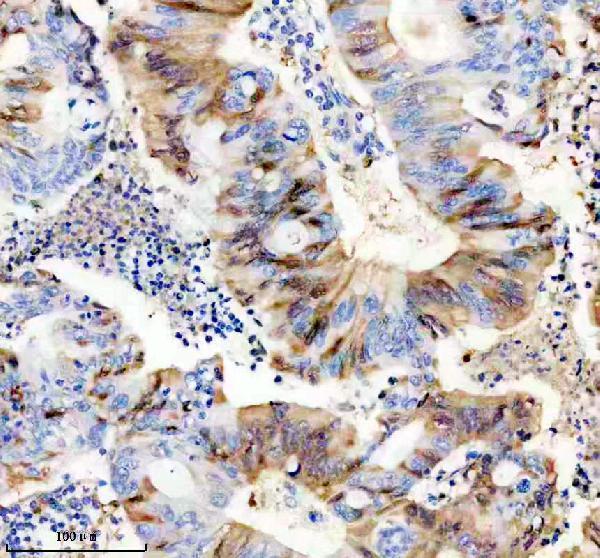 Anti-CYP1B1 Rabbit Monoclonal Antibody