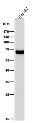 All lanes use the Antibody at 1:5K dilution for 1 hour at room temperature.