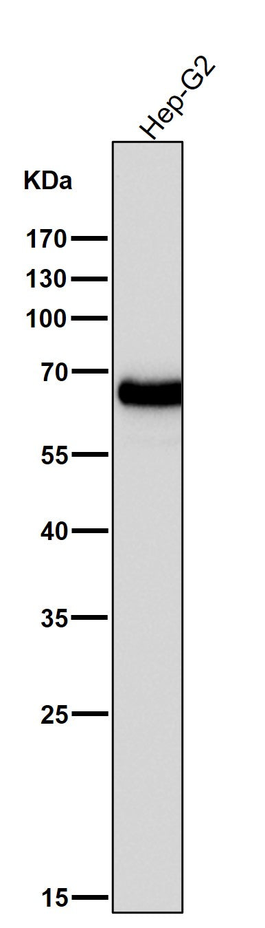 All lanes use the Antibody at 1:5K dilution for 1 hour at room temperature.