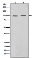 Western blot analysis of STAT6 in expression (1)Daudi cell lysate;(2)HeLa cell lysate.