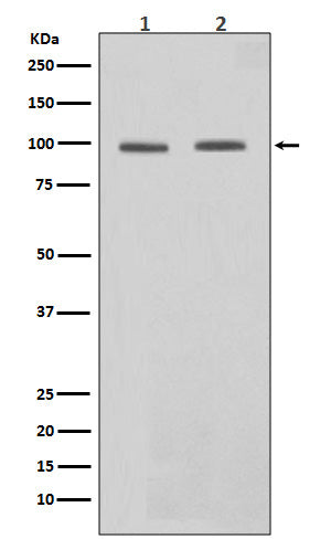 Western blot analysis of STAT6 in expression (1)Daudi cell lysate;(2)HeLa cell lysate.
