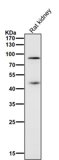 All lanes use the Antibody at 1:1K dilution for 1 hour at room temperature.