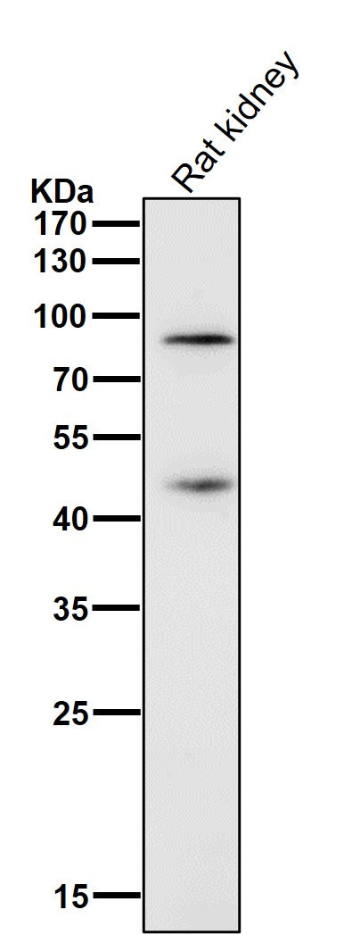 All lanes use the Antibody at 1:1K dilution for 1 hour at room temperature.