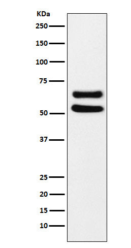 Western blot analysis of Ikaros expression in MOLT4 cell lysate.