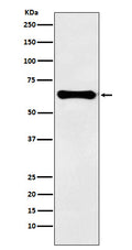 Western blot analysis of Factor IX expression in human plasma lysate.