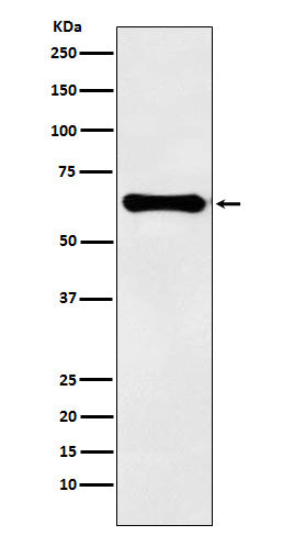 Western blot analysis of Factor IX expression in human plasma lysate.