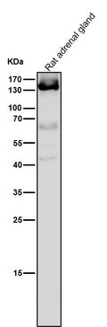 All lanes use the Antibody at 1:5K dilution for 1 hour at room temperature.