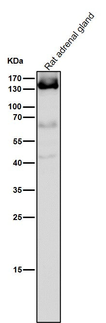 All lanes use the Antibody at 1:5K dilution for 1 hour at room temperature.