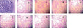 Anti-Androgen Receptor AR Rabbit Monoclonal Antibody