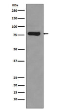 Western blot analysis of Androgen Receptor expression in 22Rv1 cell lysate.