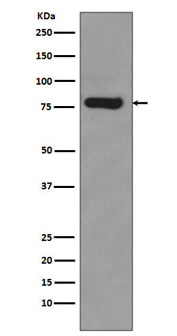 Western blot analysis of Androgen Receptor expression in 22Rv1 cell lysate.