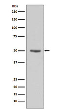 Western blot analysis of Cyclin E1 expression in HeLa cell lysates.