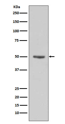 Western blot analysis of Cyclin E1 expression in HeLa cell lysates.