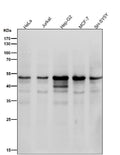 All lanes use the Antibody at 1:2K dilution for 1 hour at room temperature.