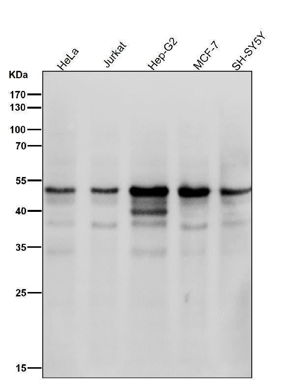 All lanes use the Antibody at 1:2K dilution for 1 hour at room temperature.