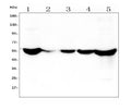 Anti-ALDH2 Antibody Picoband® (monoclonal, 5G7)