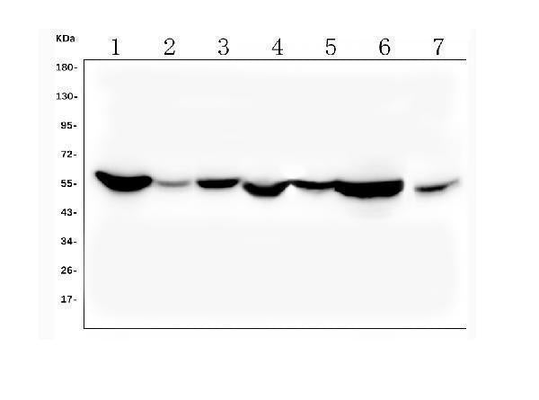Anti-ALDH2 Antibody Picoband®(monoclonal, 6H2)