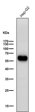 All lanes use the Antibody at 1:3K dilution for 1 hour at room temperature.