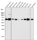 Anti-ALDH2 Monoclonal Antibody