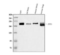 Anti-AREB6/ZEB1 Antibody Picoband® (monoclonal, 8B12D7)