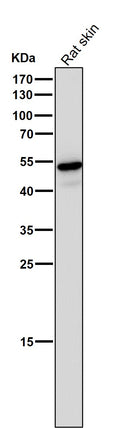 Anti-Wnt5a Rabbit Monoclonal Antibody