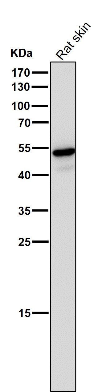 Anti-Wnt5a Rabbit Monoclonal Antibody