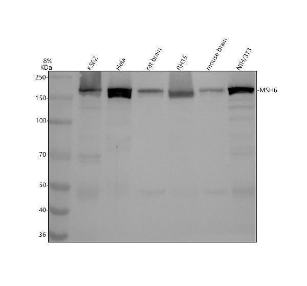 Anti-MSH6/Gtbp Rabbit Monoclonal Antibody