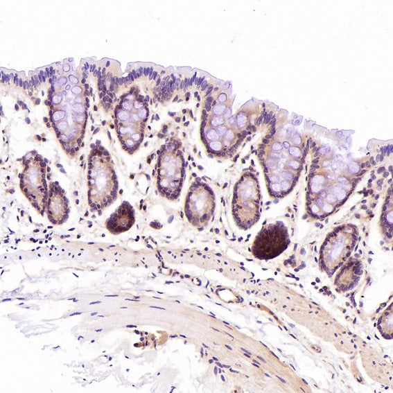 Immunohistochemical analysis of paraffin-embedded Rat stomach, using the Antibody at 1:100 dilution.