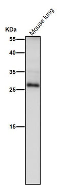 All lanes use the Antibody at 1:1K dilution for 1 hour at room temperature.