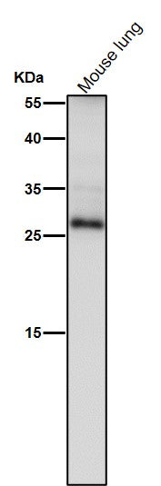 All lanes use the Antibody at 1:1K dilution for 1 hour at room temperature.