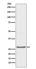 Anti-TIMP1 Rabbit Monoclonal Antibody