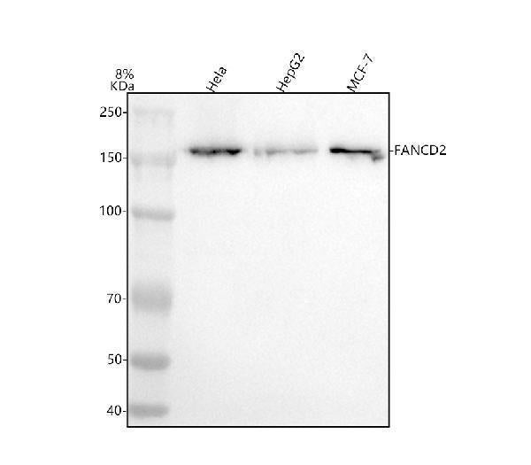 Anti-FANCD2 Rabbit Monoclonal Antibody