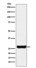 Western blot analysis of GSTM1 expression in SH-SY5Y cell lysate.