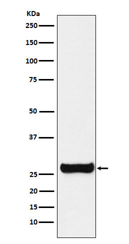 Western blot analysis of GSTM1 expression in SH-SY5Y cell lysate.